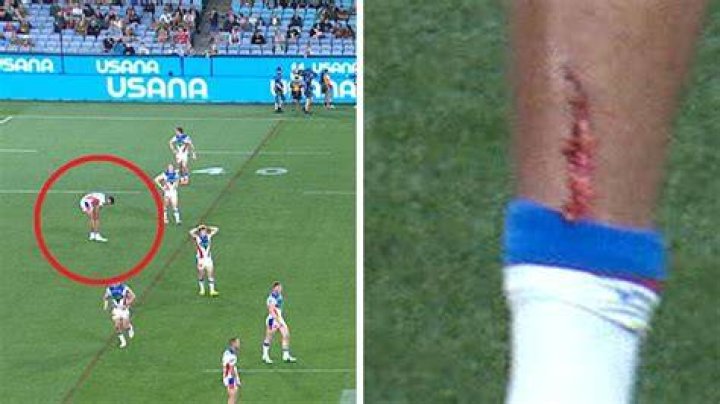 
Jonathan Pearce Injury & Surgery- What Happened To Him? 